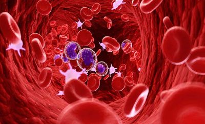 از کم خونی تا سرطان خون: همه چیز درباره بیماری های هماتولوژیک