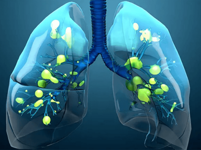 علائم اولیه بیماری تنفسی را بشناسید